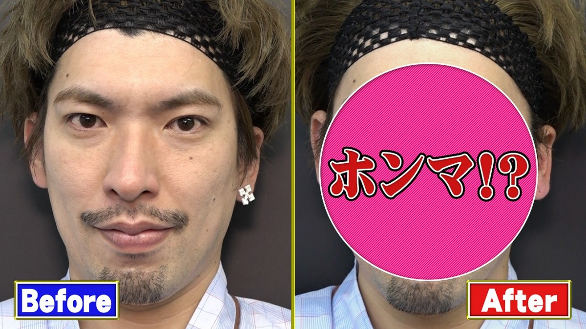Exitりんたろー オカリナ 磯野貴理子 最新美容整形 ハイフ に挑戦 Oricon News Exitりんたろー オカリナ 磯野貴理子 最新美容整形 ハイフ に挑戦 Oricon News