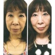 画像 写真 奇跡の69歳 上野潤子さんフォトギャラリー 12枚目 Oricon News