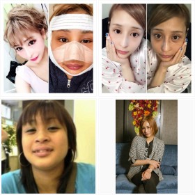 ���`�O��₷���҂�ʐ^���c�����L���o�N����В��E�����̉ԃt�H�g�M�������[