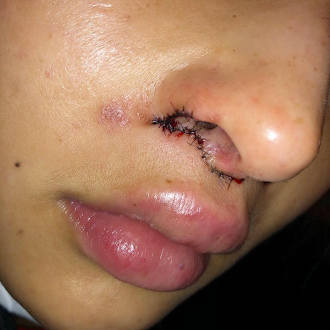 ���`��p�_�E���^�C����