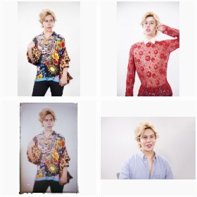 整形男子アレン フォトギャラリー