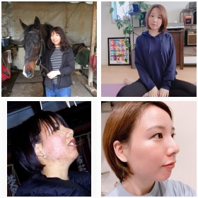 【ダイエットビフォーアフター】15キロの減量に成功した詩乃さんフォトギャラリー