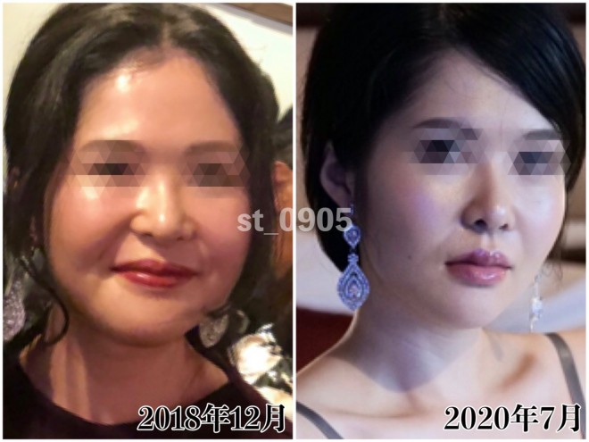 tH[SSRO{֊s`p10ijƌ݁iEji摜񋟁Fseinaj