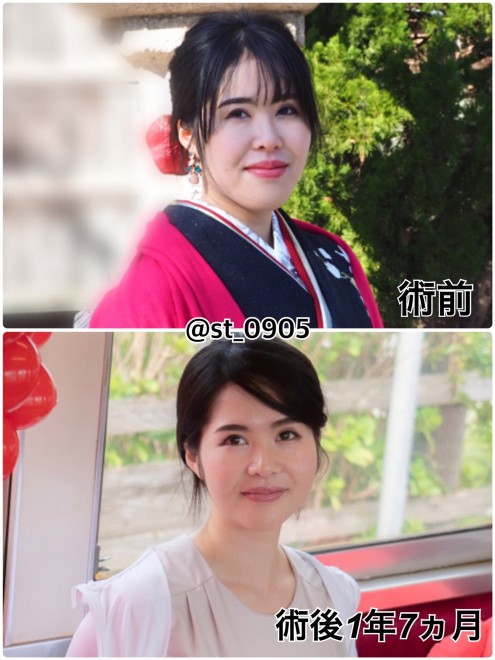 {Ɨ֊s̐`rtH[At^[i摜񋟁Fseinaj