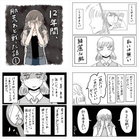【漫画】12年間、肌荒れと戦った話