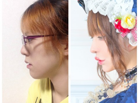 �{�̎�p�O�ƌ� �{�l��