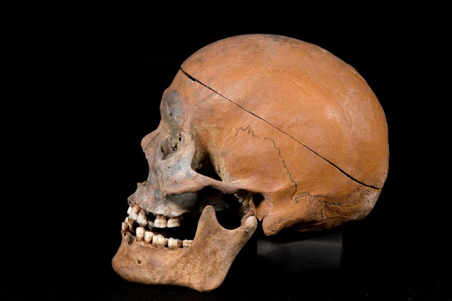 挧̐J㎛nՂ甭@ꂽlƂɕw퐶lx