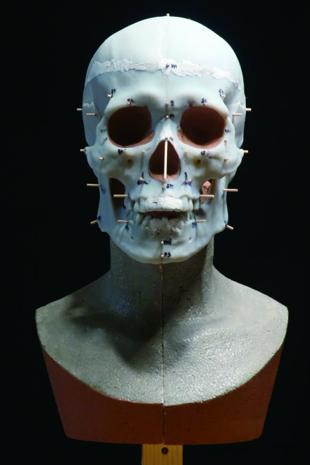 挧̐J㎛nՂ甭@ꂽlƂɕw퐶lx