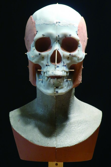 挧̐J㎛nՂ甭@ꂽlƂɕw퐶lx