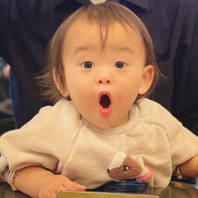 天使キッズ カブトガニヘアーと呼ばれることも 薄毛の赤ちゃんが少女の髪になるまでの成長動画に860万再生 Oricon News