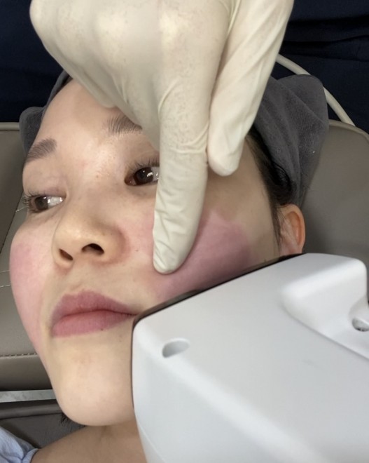 �C�����[�hFX �B�e�F��ݐ^�R