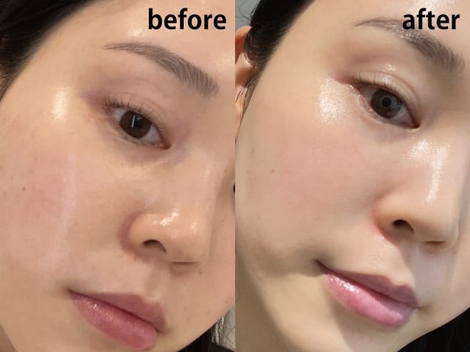 �n���E�b�h�_�C�A�g�[�j���O���[�U�[ �B�e�F��ݐ^�R