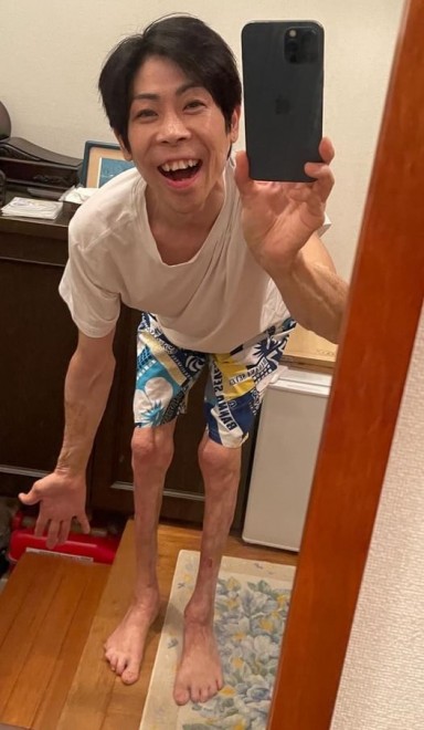 �S�g��40���ɂ₯�ǂ𕉂����_�����M����