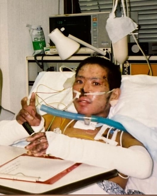 �S�g��40���ɂ₯�ǂ𕉂����������_�����M����