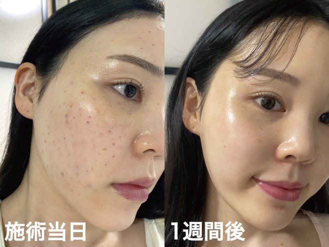 ���W���������� �B�e�F��ݐ^�R