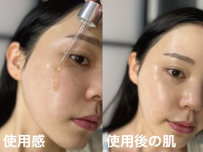 medicube�w�O���^�`�I���O���E�A���v���x �B�e�F��ݐ^�R