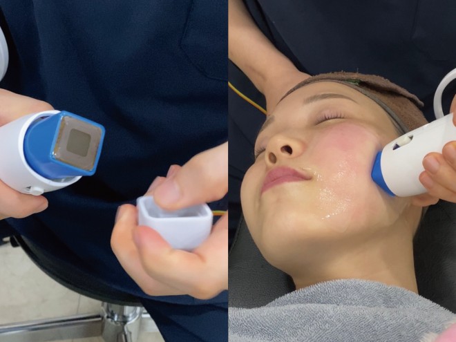 �e���T�[�} �B�e�F��ݐ^�R