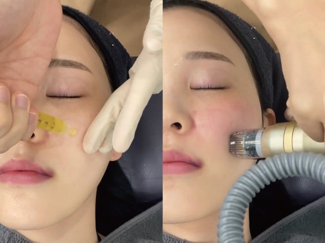 �V���t�@�[��X �B�e�F��ݐ^�R