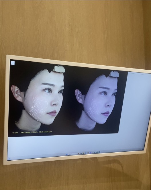 �`���[���t�F�C�X �B�e�F��ݐ^�R