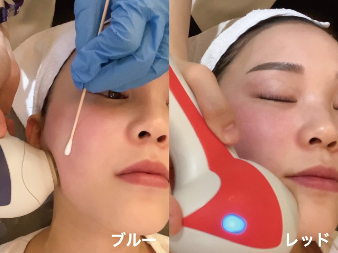 �`���[���t�F�C�X �B�e�F��ݐ^�R