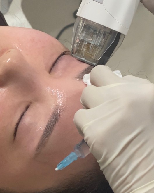 �o�[�`��RF���[�U�[ �B�e�F��ݐ^�R