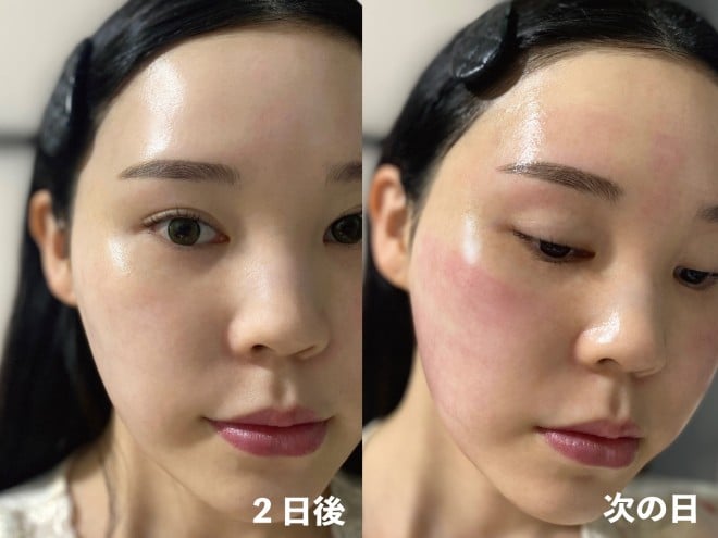 �o�[�`��RF���[�U�[ �B�e�F��ݐ^�R