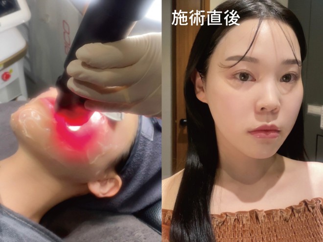 �u���b�h�^�b�`���[�U�[ �v���v �B�e�F��ݐ^�R