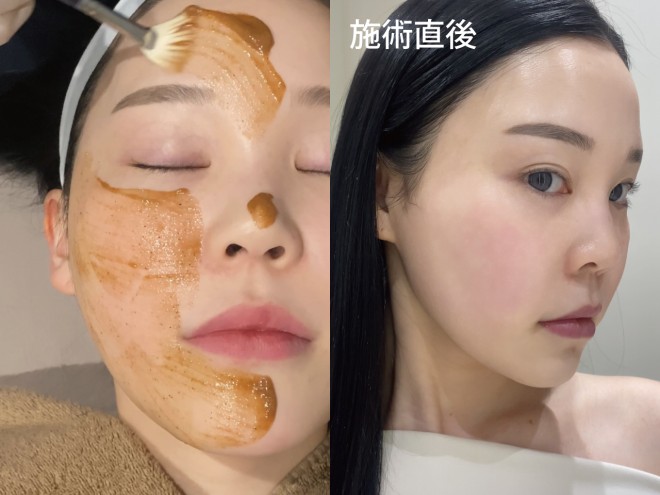 �u���ڂ���s�[���v �B�e�F��ݐ^�R