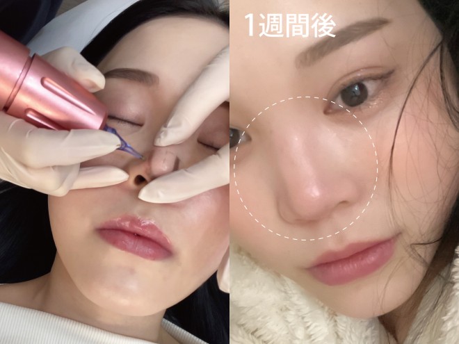 �u���@�k���A�[�g�v �B�e�F��ݐ^�R