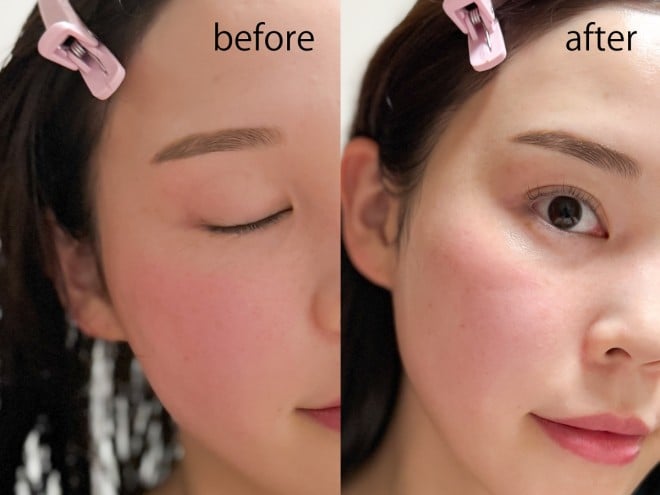 MEDIHEAL�w�}�f�J�b�\�V�h�G�b�Z���V�����}�X�N�x �B�e�F��ݐ^�R