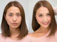 顔中ニキビ0個 ギャルモデルの壮絶な肌荒れ 告白動画 に反響 やっと解放された Oricon News