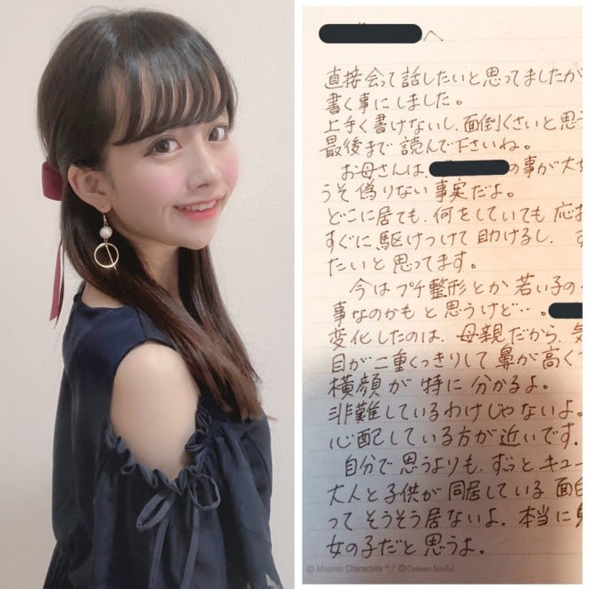 整形 親にバレてた 母からの手紙に自戒の念 元アイドル語る 整形沼 からの脱出 Oricon News