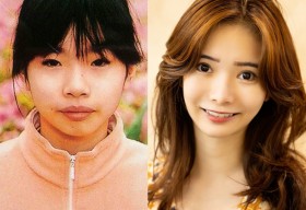 ���z420���A10��̎{�p����N�Ƃ�������