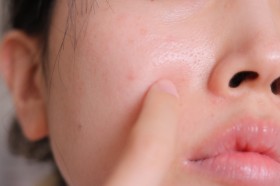 �N��ƂƂ��ɋC�ɂȂ�u����ݖь��v�A����łł���ȒP�X�L���P�A�@�Ƃ�