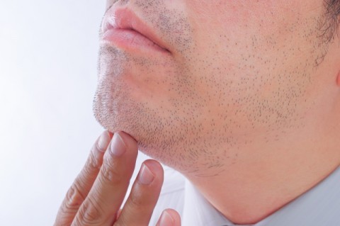 【医師に聞く】「AGA治療で体毛が濃くなる?」「脱毛と同時進行は？」 薬の副作用と対処法、ウワサの真相は  