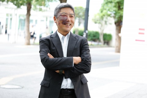 顔面に“赤アザ”を持つ男性　当事者同士の関わりで見えた“課題”「親が子どもの状態を理解していない、受け止めていない人が多い」