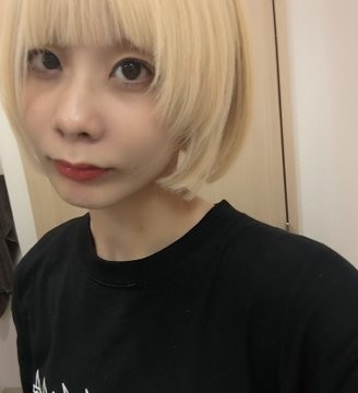 「最終目標は顔面に囚われなくなること」心ない言葉に約10年マスクが手放せなかった“顎変形症”の女性が発信する理由