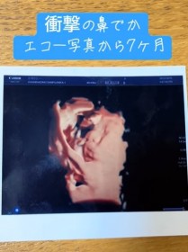 �y�L�b�Y�z�}�}�Ռ��́g�@�ł��h�G�R�[�ʐ^����7������c���܂ꂽ�x�r�[�̎p�́H