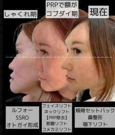 �g���`��D���h54�Ώ����A4,500�������ĊO���𖁂������郏�P�u�Y��Ȏq�ɑ΂���l�̑Ή���@���Ɋ����Ă��܂��v