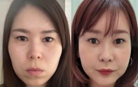 【整形美女】元彼の心ない言葉よりショックだったのは“鏡に写る老けた自分の姿”…全財産使って美女を目指した女性の境地 