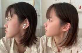 “顎いじり”を笑いに変えた過去も…顎変形症の手術でコンプレックスを消した女性「自分が自分に自信を持てることが大切」
