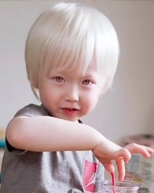 アルビノの小学生息子に“かっこいいやん！”SNSで広がる理解