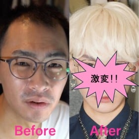 めちゃくちゃ好みのイケメン爆誕…薄毛＆肌荒れの男性が激変、メイクとウィッグで手に入れた“別人格”「逆に素の自分を受け入れられた」