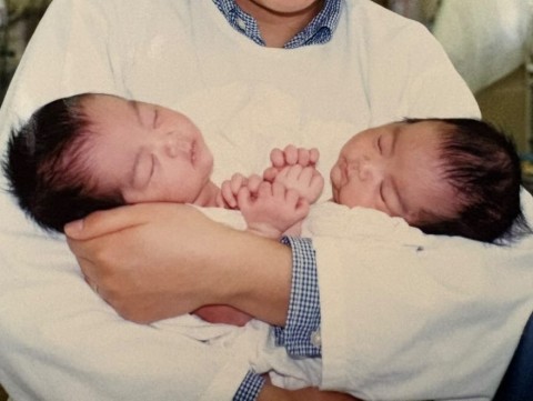 20年生きられる確証は無かった…結合双生児の姉妹と母親が分離手術から成人までを振り返る「振袖を着られたことは奇跡」「写真は宝物」