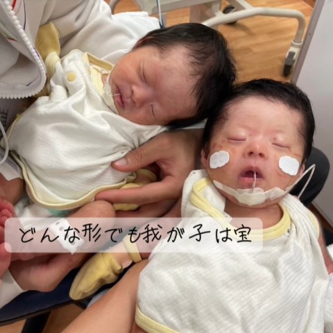 ダウン症で生まれた双子と出会い、子どもたちが教えてくれた「今を大切に生きる」という価値観
