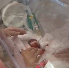 661g�Ő��܂ꂽ�����Ȗ��@25�T�̑��Y��NICU���������z���u���ʂȂ瓖����O�̐������A���{���������v