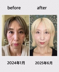 �u��������̂����ł����v 50�Ώ�����1�N����Ɍ������p��178.8���\�� �u����݂����傶��ɖ����Ȃ��Ă�v�u�n���ȓw�͂Ɋ��S�v