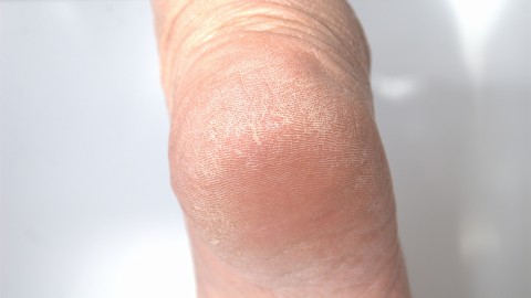 �u��݂����ɍd���v�u�Ђ��������Ēɂ��c�v�����Ƃ����܂�ς��A�������n�߂�W���P�A