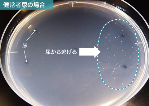 2人に1人はがん経験するも受診率は昨年比8 に低下 自宅検査キットで感染リスクなく早期発見を Oricon News