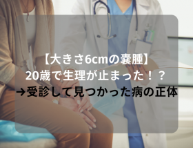 �y�傫��6cm�̔X��z20�΂Ő������~�܂����I�H����f���Č��������g�a�̐��́h�Ƃ�